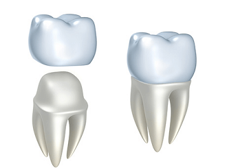 Porcelain Crowns Brighton Dental Office