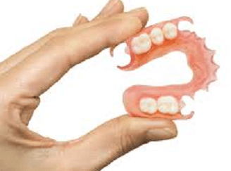 dental bridge - fixed bridge